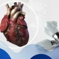 ایمپلنت دندان برای بیماران قلبی