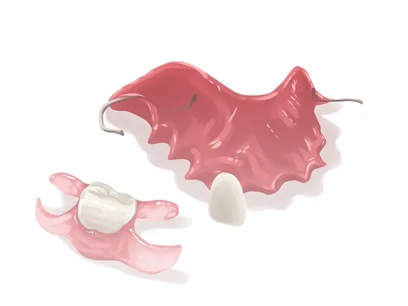  فلیپر دندان