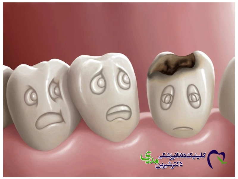 چه کسی باید از ایمپلنت‌های دندانی اجتناب کند؟