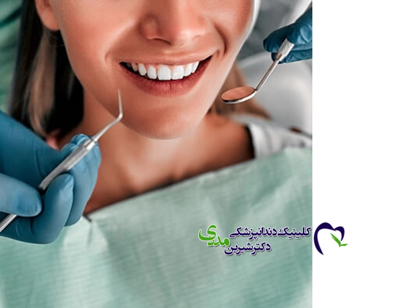 کامپوزیت لب شیشه‌ای