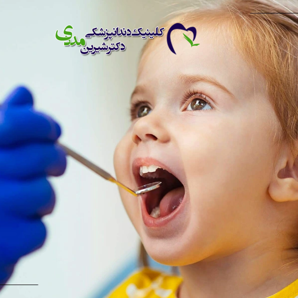 ایمپلنت دندان کودکان