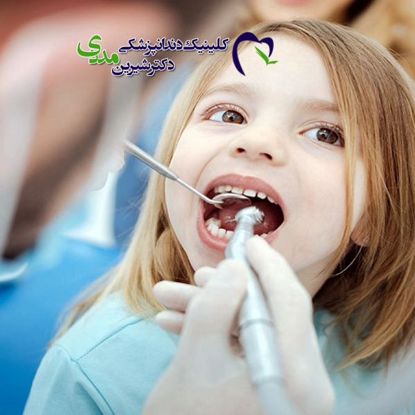 بهترین جایگزین ‌های ایمپلنت برای کودکان در اهواز 